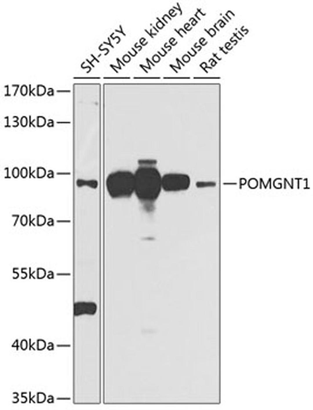 Western blot - POMGNT1 antibody (A9879)