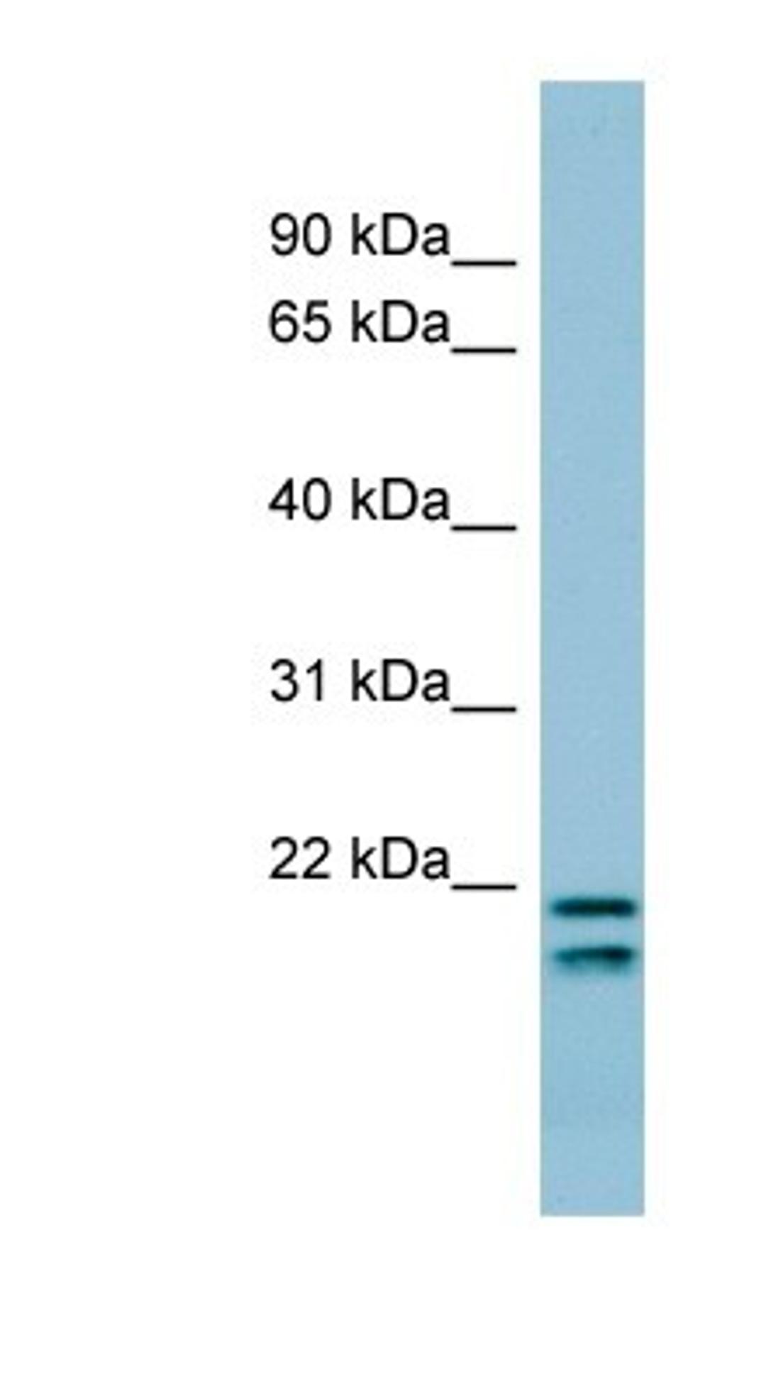 Western Blot: Prosurfactant Protein C Antibody [NBP1-60117] - Titration: 0.2-1 ug/ml, Positive Control: COLO205 cell lysate.