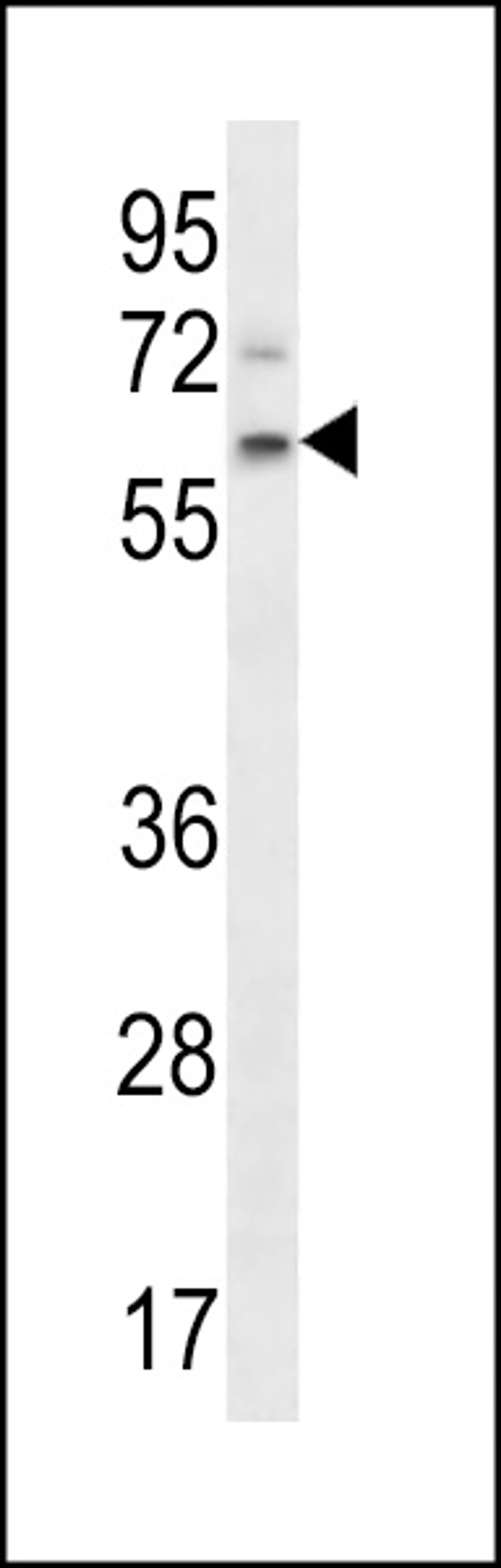 Western blot analysis in NCI-H292 cell line lysates (35ug/lane).