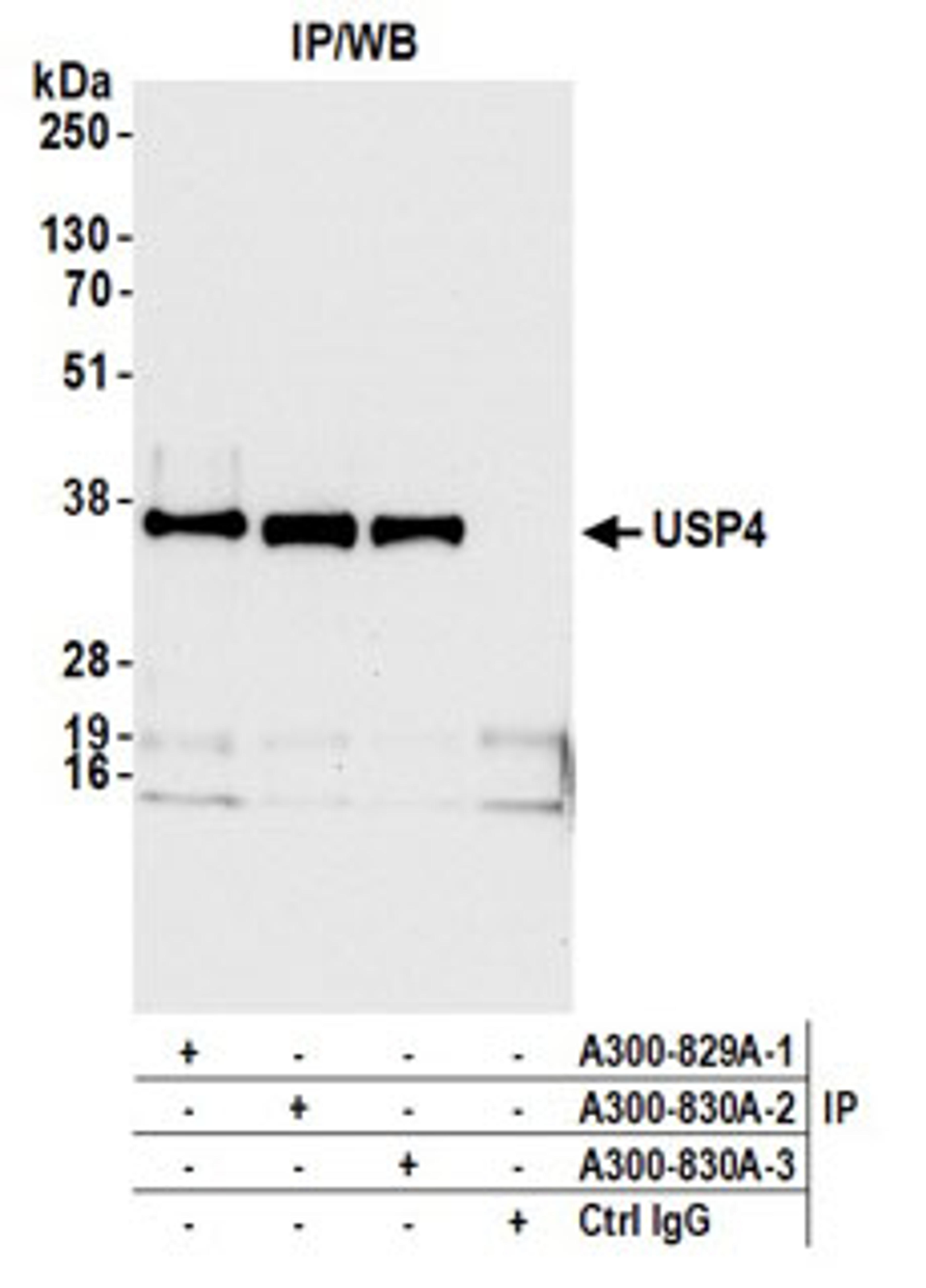 Detection of human USP4 by western blot of immunoprecipitates.