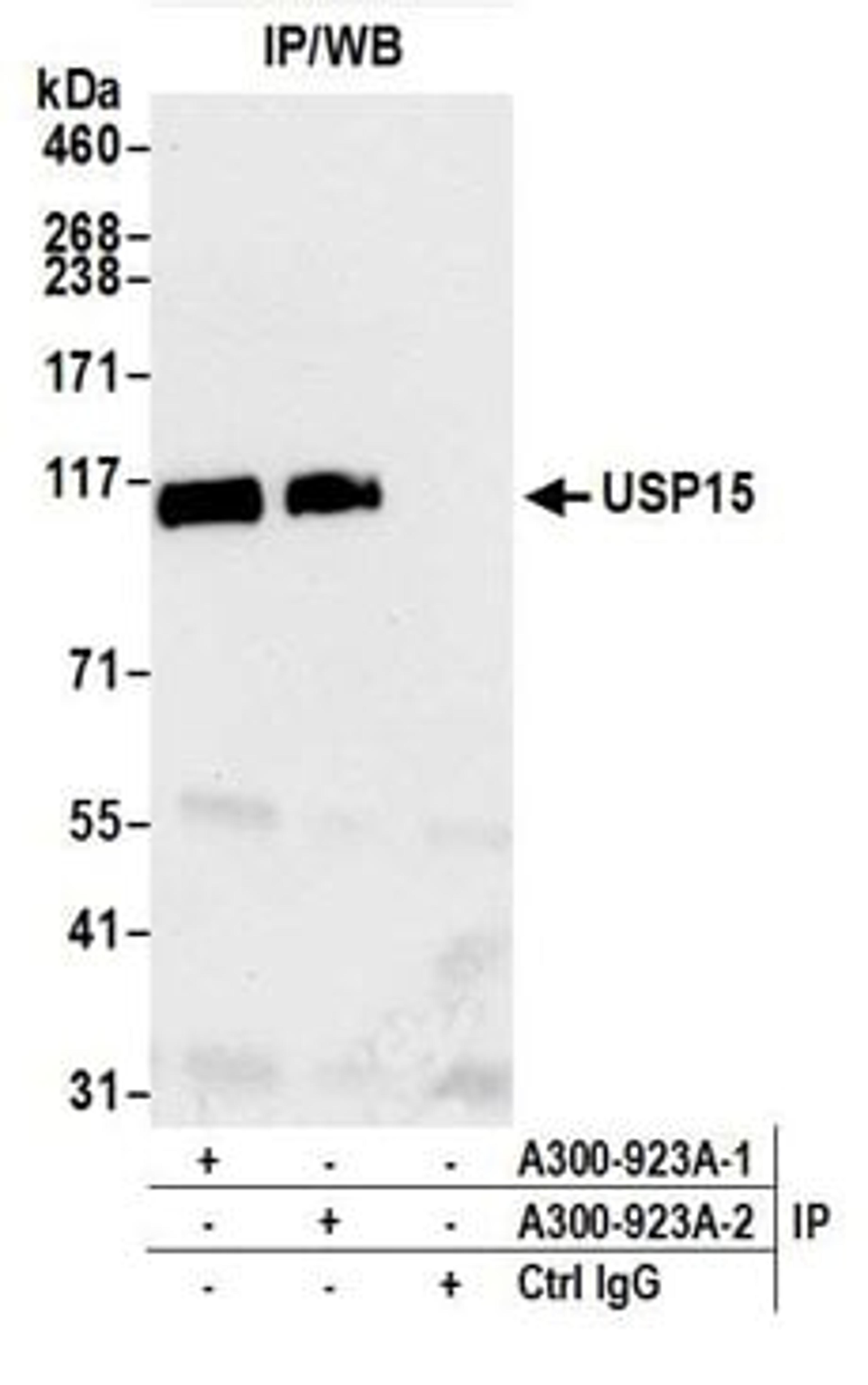 Detection of human USP15 by western blot of immunoprecipitates.