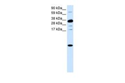 Antibody used in WB on Human Small Intestine at 0.0758 ug/ml.