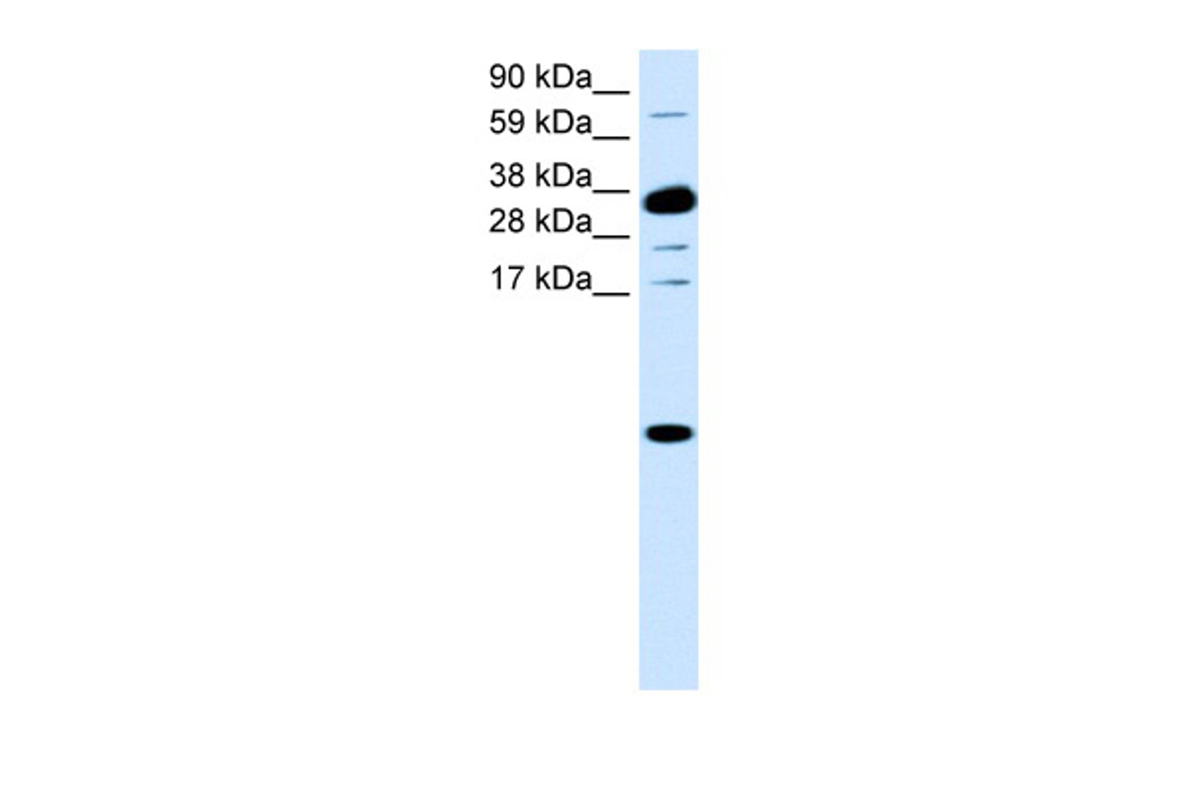 Antibody used in WB on Human Small Intestine at 0.0758 ug/ml.