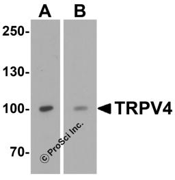 Western blot analysis of TRPV4 in (A) human testis tissue and (B) SK-N-SH cell lysate with TRPV4 antibody at 1 μg/mL.