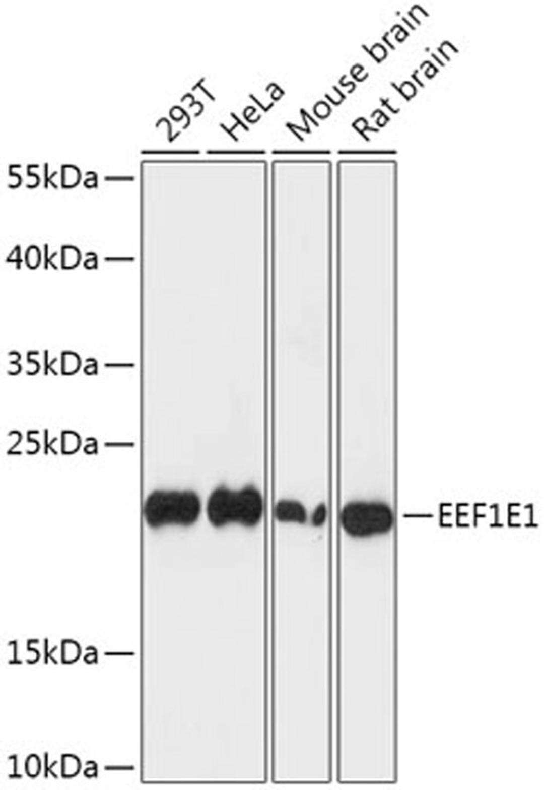 Western blot - EEF1E1 antibody (A15357)