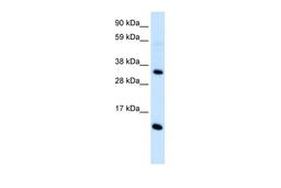 Antibody used in WB on Human Thymus at 0.2-1 ug/ml.