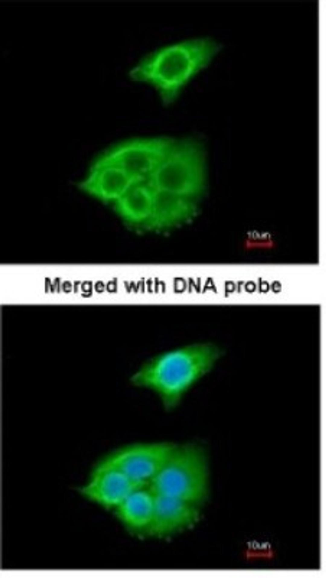 Immunocytochemistry/Immunofluorescence: Pancreatic Lipase Antibody [NBP1-32789] - Paraformaldehyde-fixed A549, using antibody at 1:200 dilution.