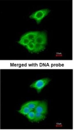 Immunocytochemistry/Immunofluorescence: Pancreatic Lipase Antibody [NBP1-32789] - Paraformaldehyde-fixed A549, using antibody at 1:200 dilution.