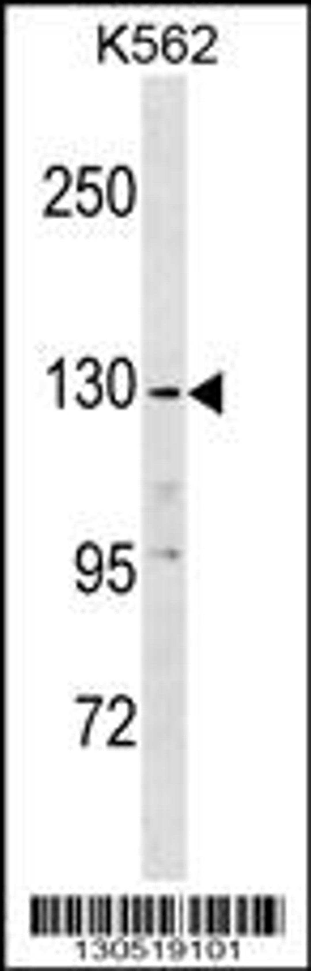 Western blot analysis in K562 cell line lysates (35ug/lane).