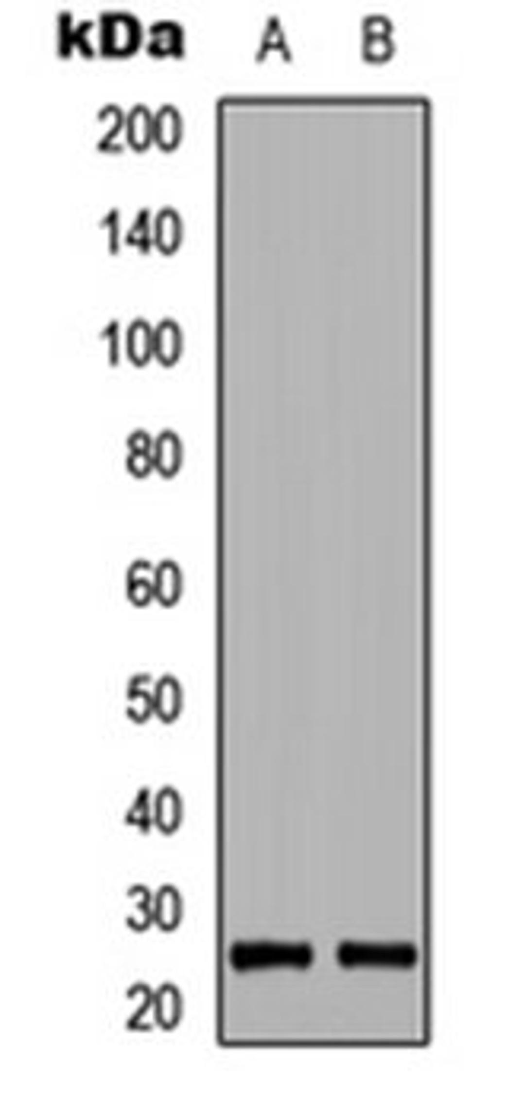 Western blot analysis of HEK293T (Lane 1), Raw264.7 (Lane 2) whole cell lysates using BIM (phospho-S69) antibody