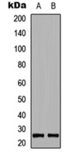 Western blot analysis of HEK293T (Lane 1), Raw264.7 (Lane 2) whole cell lysates using BIM (phospho-S69) antibody