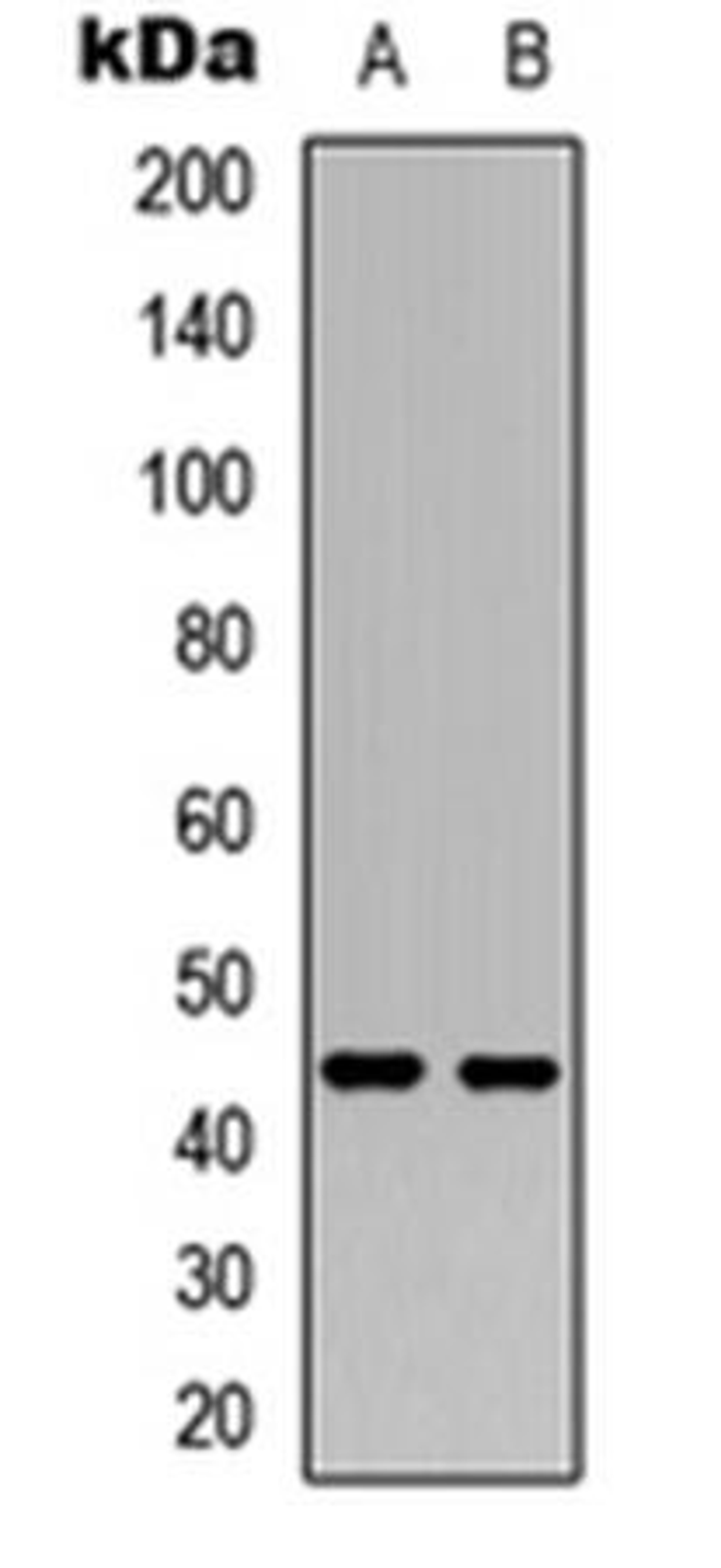 Western blot analysis of HepG2 (Lane1), HeLa (Lane2) whole cell using NR2F2 antibody