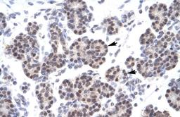 Antibody used in IHC on Human Pancreas at none (Lane 2: 15ug MCF7 lysate).