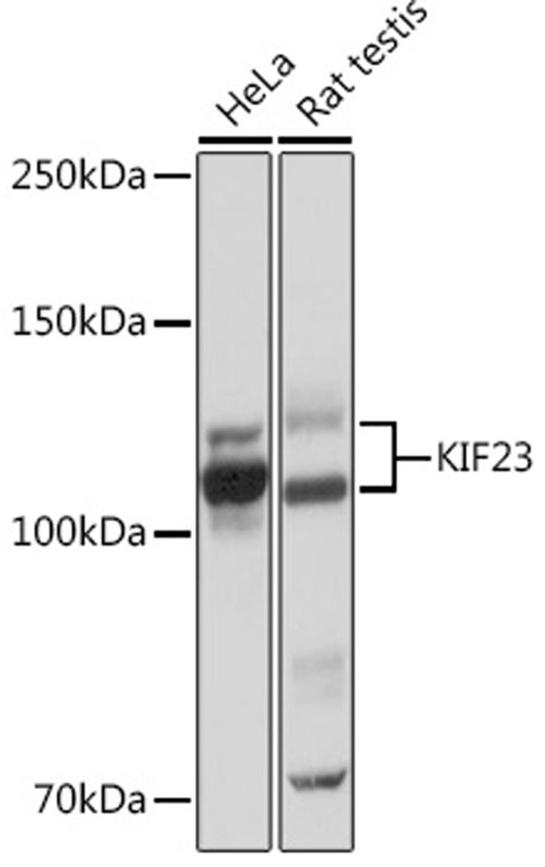 Western blot - KIF23 Rabbit mAb (A4896)