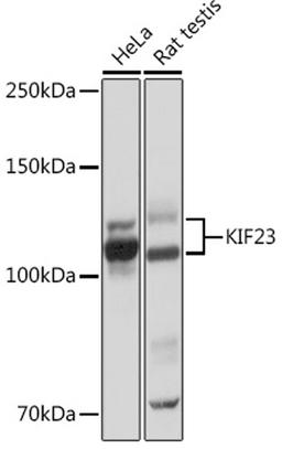 Western blot - KIF23 Rabbit mAb (A4896)