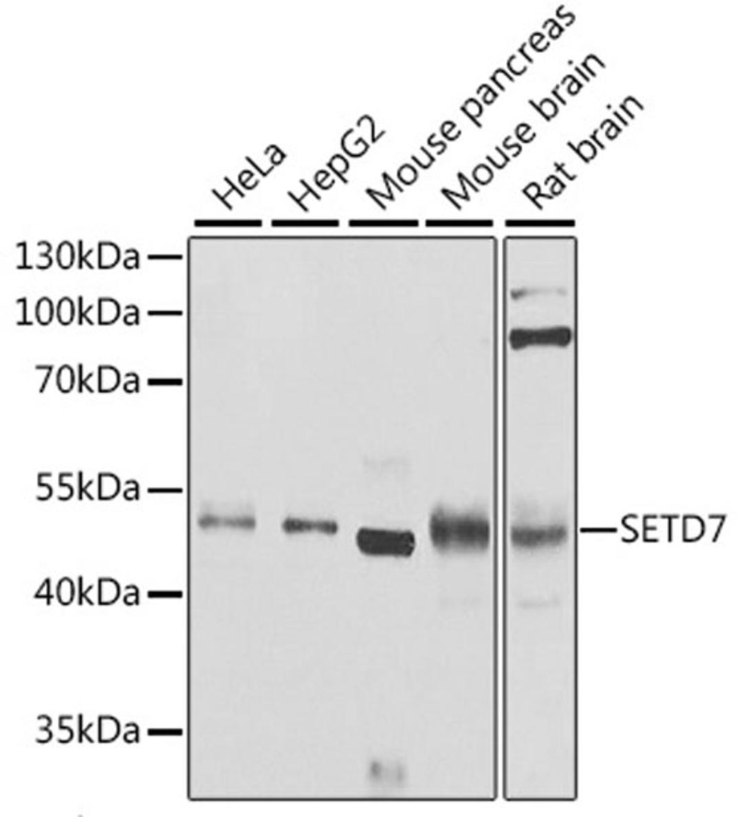 Western blot - SETD7 antibody (A9985)