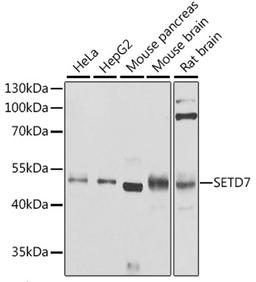 Western blot - SETD7 antibody (A9985)