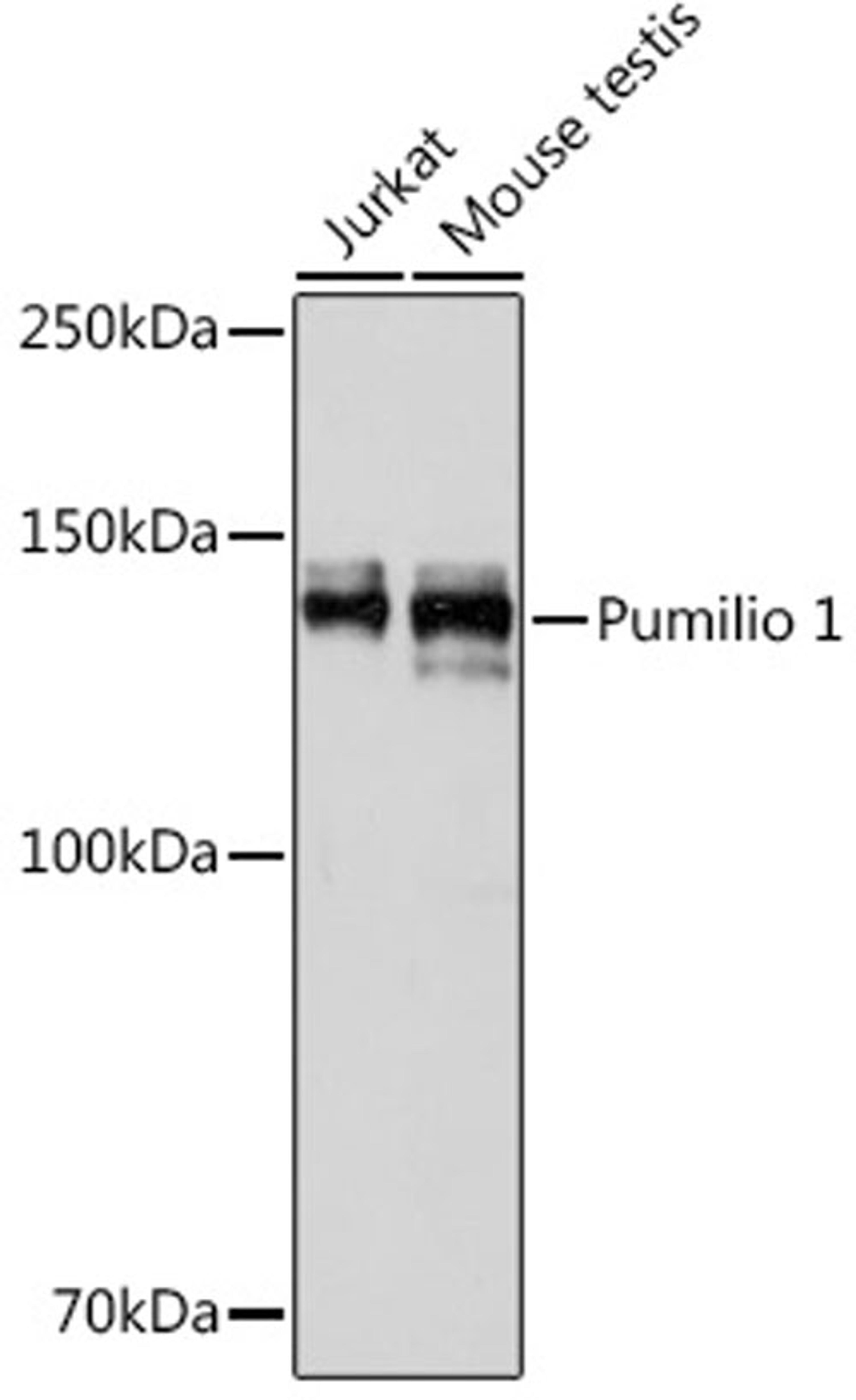 Western blot - Pumilio 1 Rabbit mAb (A0571)