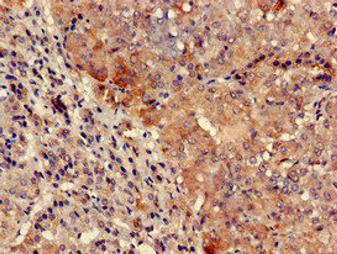 Immunohistochemistry of paraffin-embedded human adrenal gland tissue using CSB-PA025391LA01HU at dilution of 1:100