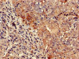 Immunohistochemistry of paraffin-embedded human adrenal gland tissue using CSB-PA025391LA01HU at dilution of 1:100