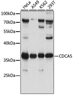 Western blot - CDCA5 antibody (A16590)