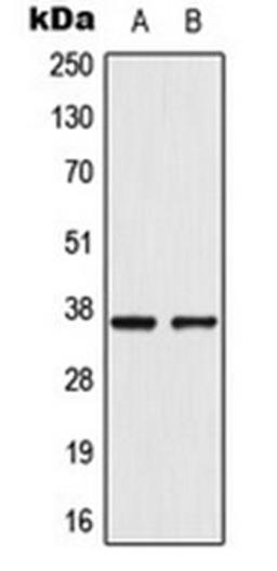 Western blot analysis of VEC (Lane 1), A549 (Lane 2) whole cell lysates using AKR1CL2 antibody