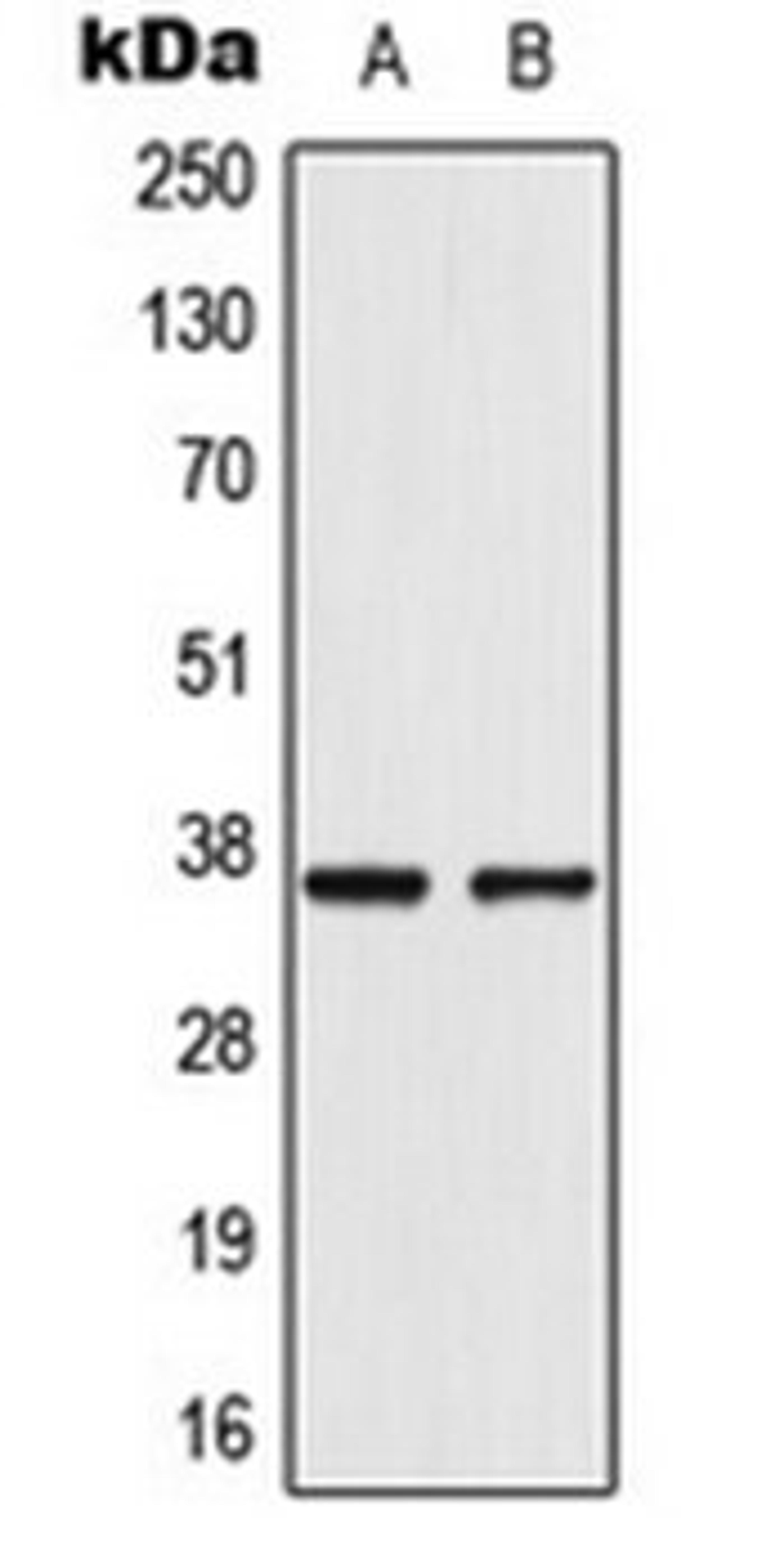 Western blot analysis of VEC (Lane 1), A549 (Lane 2) whole cell lysates using AKR1CL2 antibody