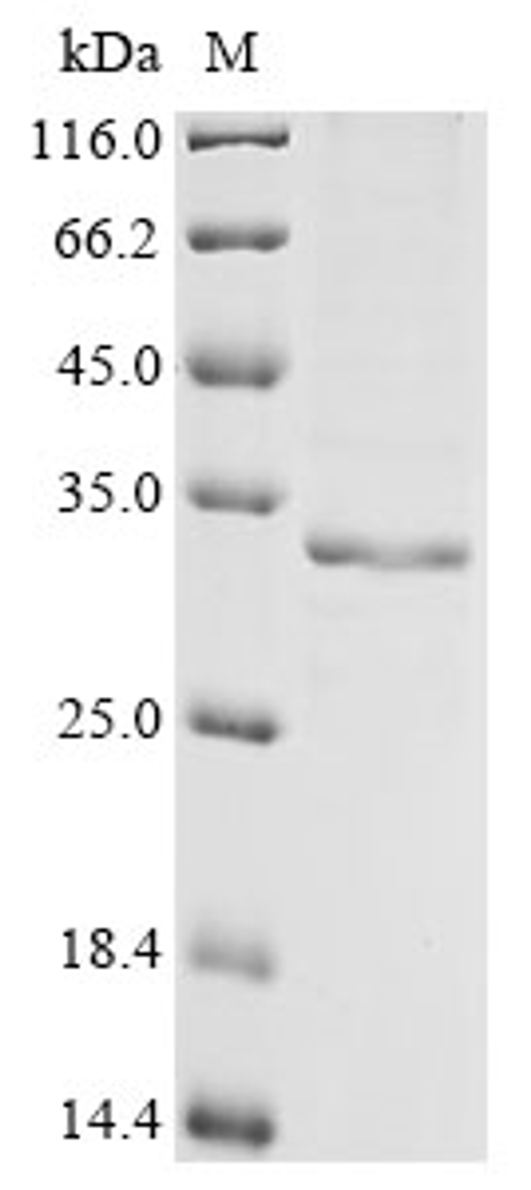 (Tris-Glycine gel) Discontinuous SDS-PAGE (reduced) with 5% enrichment gel and 15% separation gel.