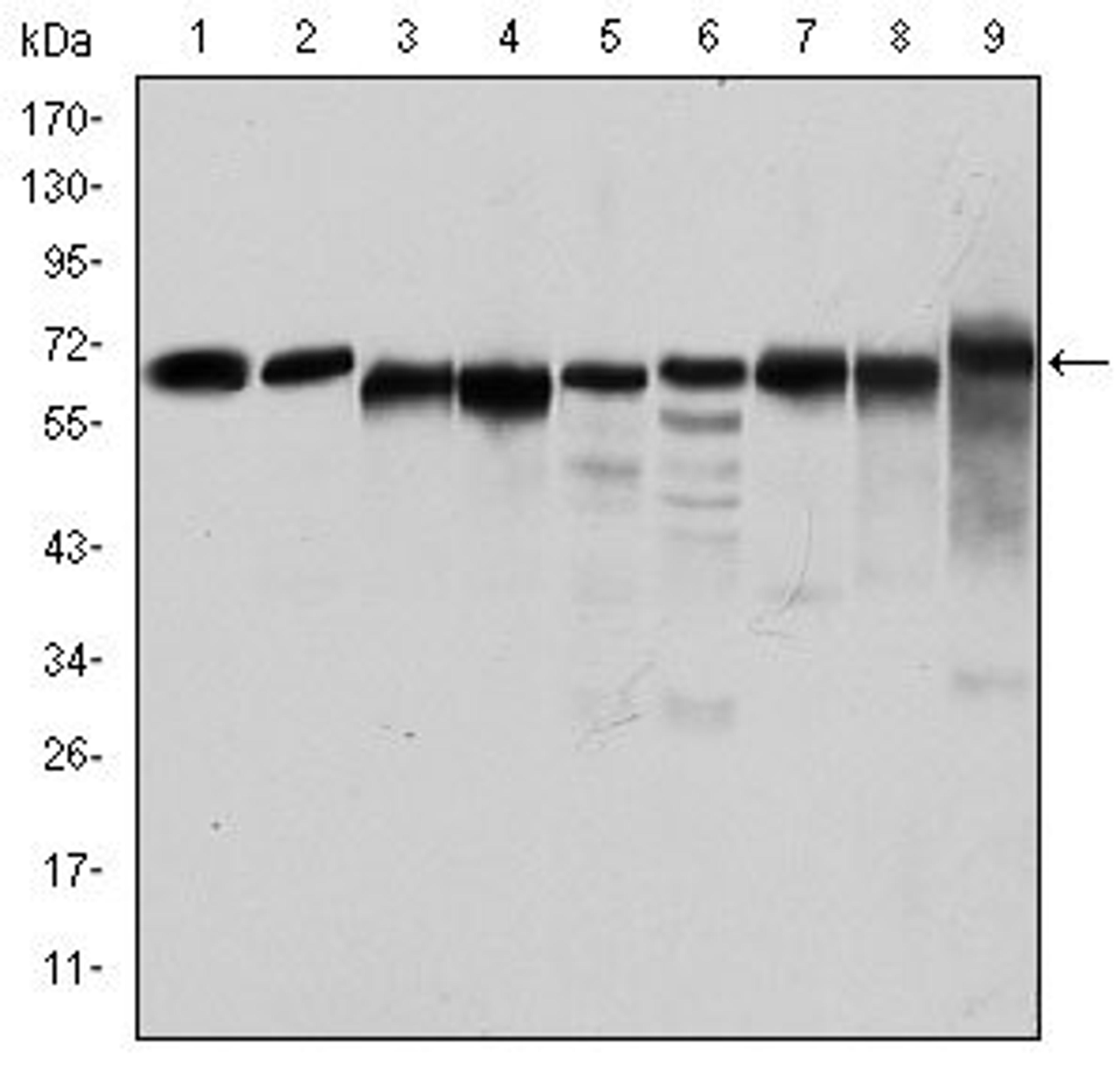 Western blot analysis of Jurkat (Lane1), Hela (Lane2), HepG2 (Lane3), MCF-7 (Lane4), Cos7 (Lane5), NIH/3T3 (Lane6), K562 (Lane7), HEK293 (Lane8), and PC-12 (Lane9) cell lysate using AMPK alpha 1 Antiboy antibody