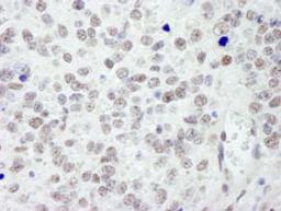 Detection of mouse RanBP3 by immunohistochemistry.