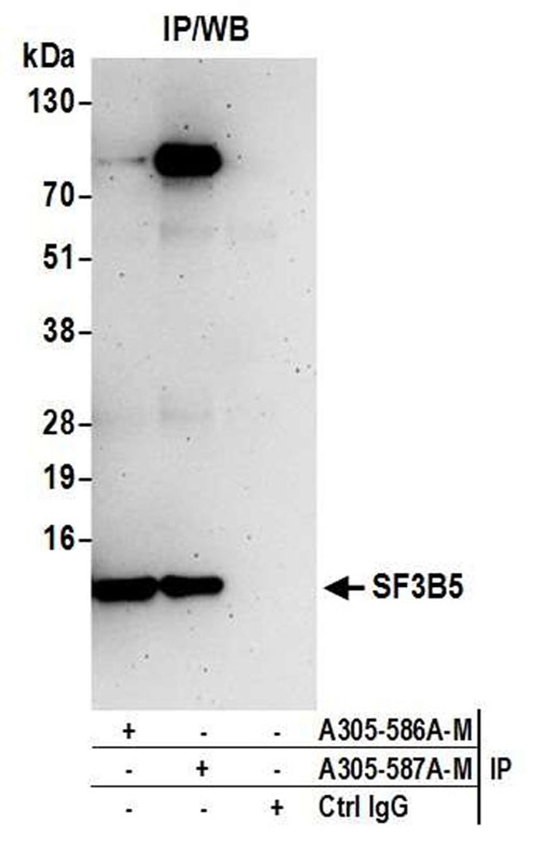 Detection of human SF3B5 by WB of IP.