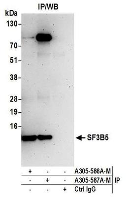 Detection of human SF3B5 by WB of IP.