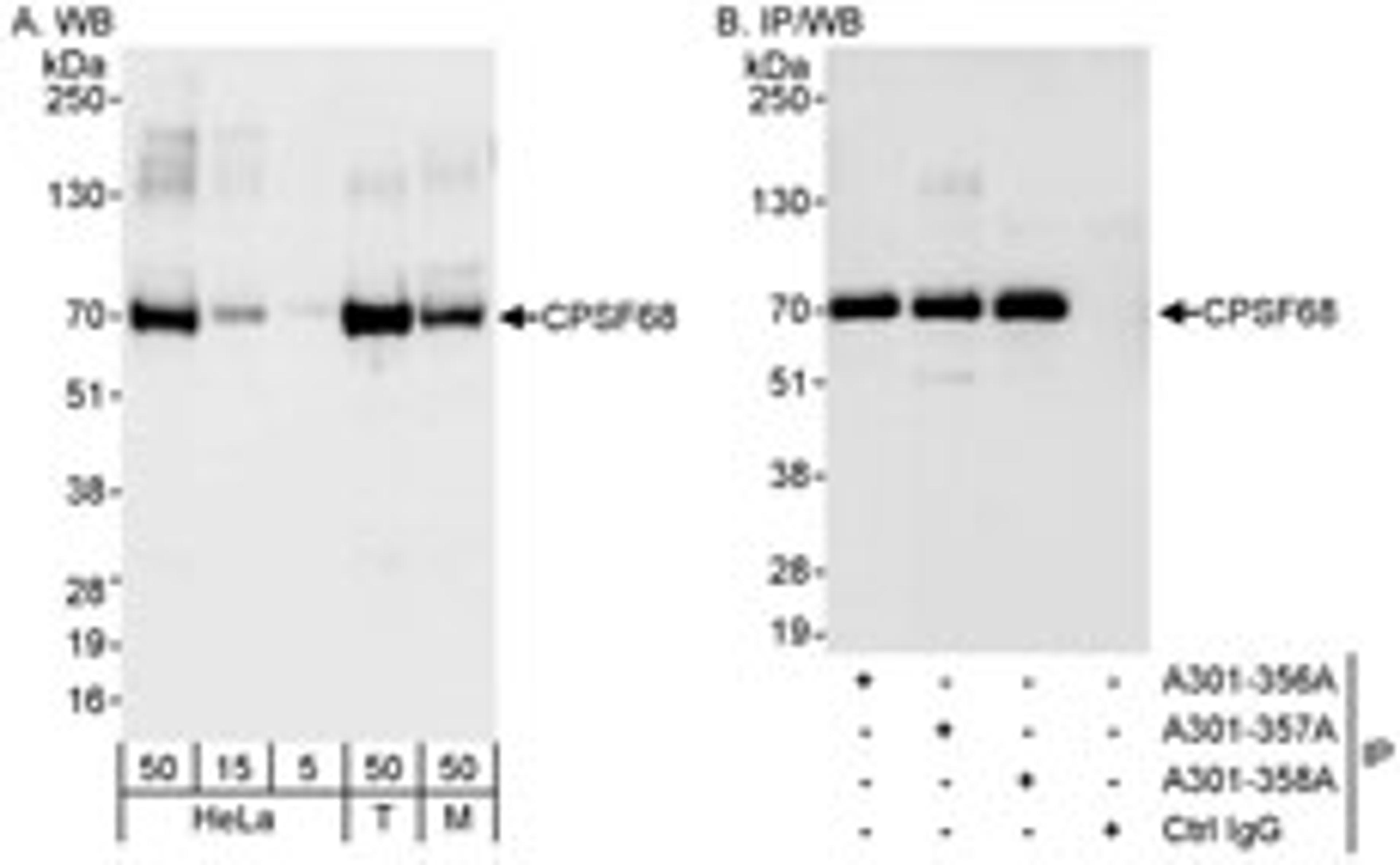 Detection of human and mouse CPSF68 by western blot (h&m) and immunoprecipitation (h).