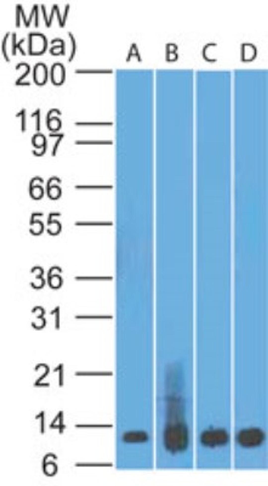 Western Blot: S100A8/A9 Antibody (48M7C7) [NBP2-25256] - analysis of S100A8 in A) recombinant protein, B) human spleen, C) HL60 and D) PC3 lysate using S1008A antibody at 0.5 ug/ml. goat anti-mouse Ig HRP secondary antibody and PicoTect ECL substrate solution were used for this test.