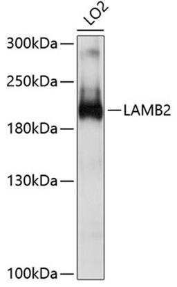 Western blot - LAMB2 antibody (A10565)