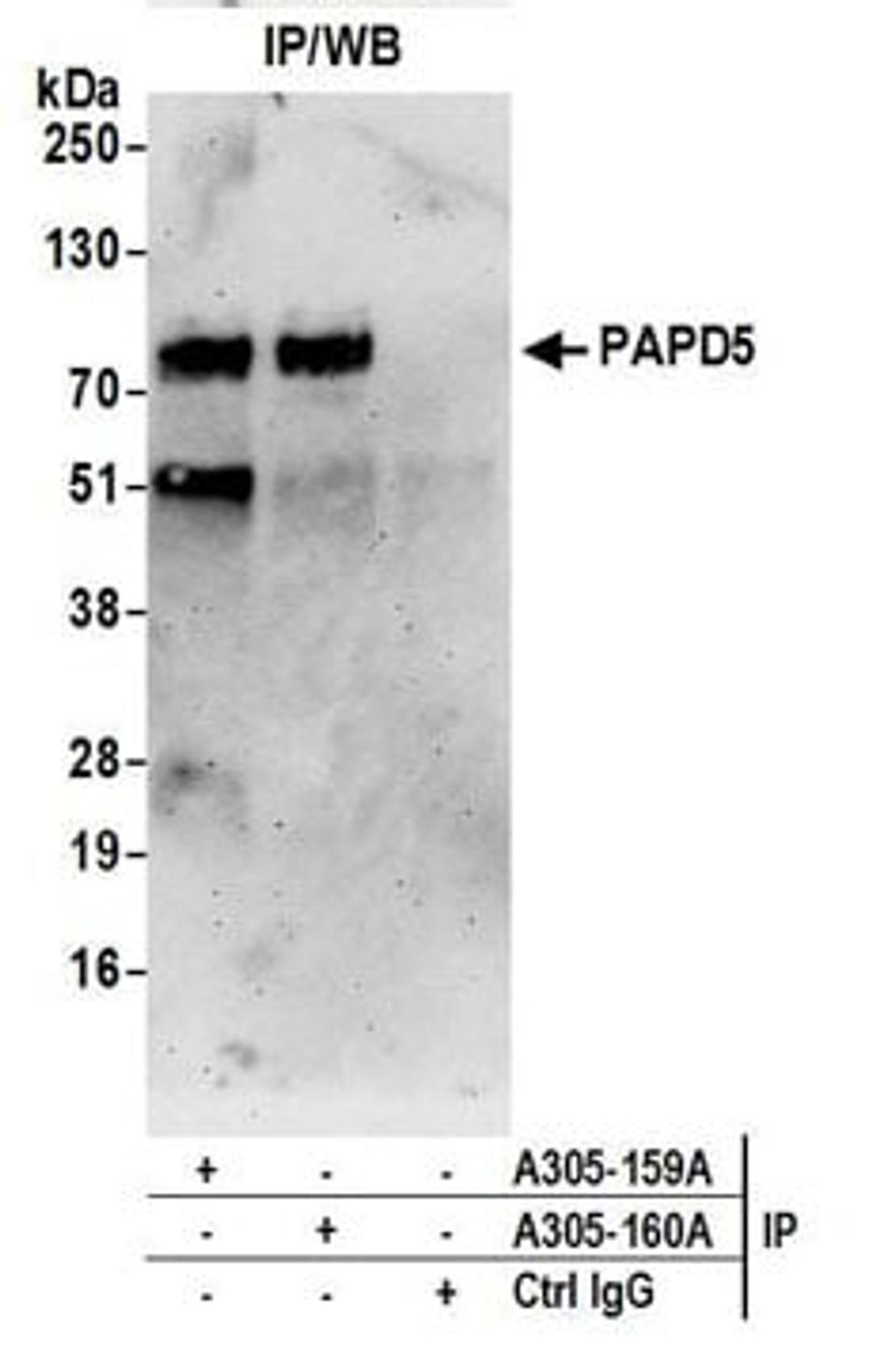 Detection of human PAPD5 by western blot of immunoprecipitates.