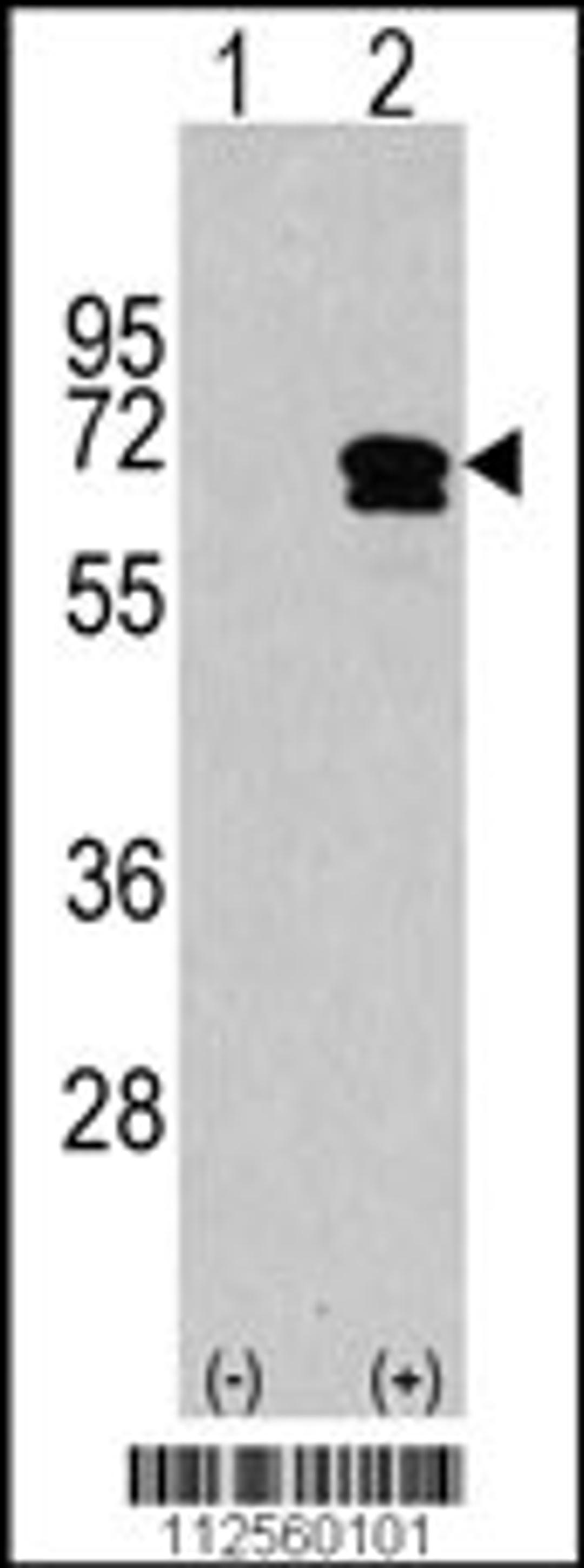 Western blot analysis of CAMKK2 using rabbit polyclonal CAMKK2 Antibody using 293 cell lysates (2 ug/lane) either nontransfected (Lane 1) or transiently transfected with the CAMKK2 gene (Lane 2).