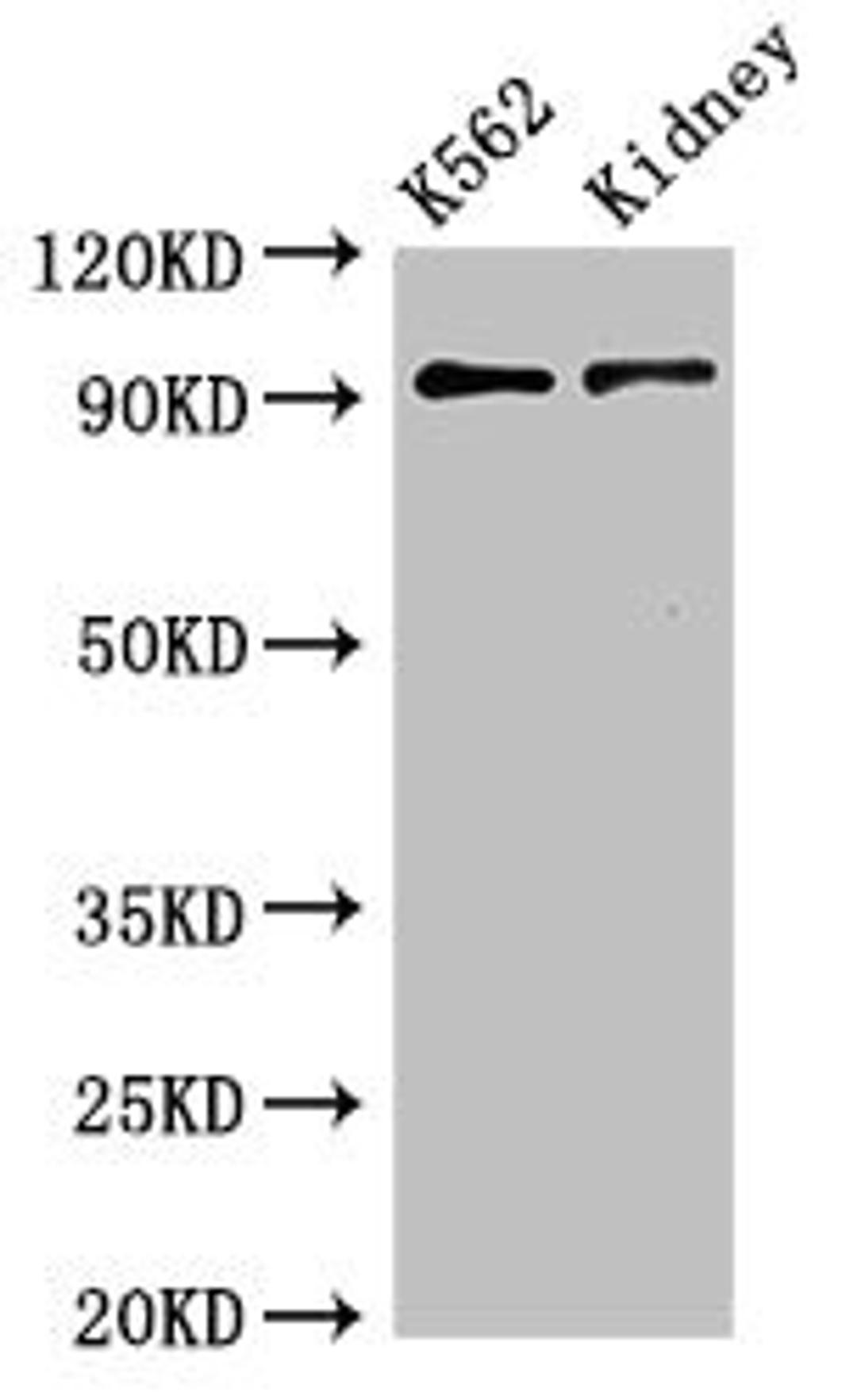Western Blot. Positive WB detected in:K562 whole cell lysate,Mouse kidney tissue. All lanes:AP1G1 antibody at 3.4µg/ml. Secondary. Goat polyclonal to rabbit IgG at 1/50000 dilution. Predicted band size: 92 KDa. Observed band size: 92 KDa