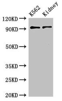 Western Blot. Positive WB detected in:K562 whole cell lysate,Mouse kidney tissue. All lanes:AP1G1 antibody at 3.4µg/ml. Secondary. Goat polyclonal to rabbit IgG at 1/50000 dilution. Predicted band size: 92 KDa. Observed band size: 92 KDa