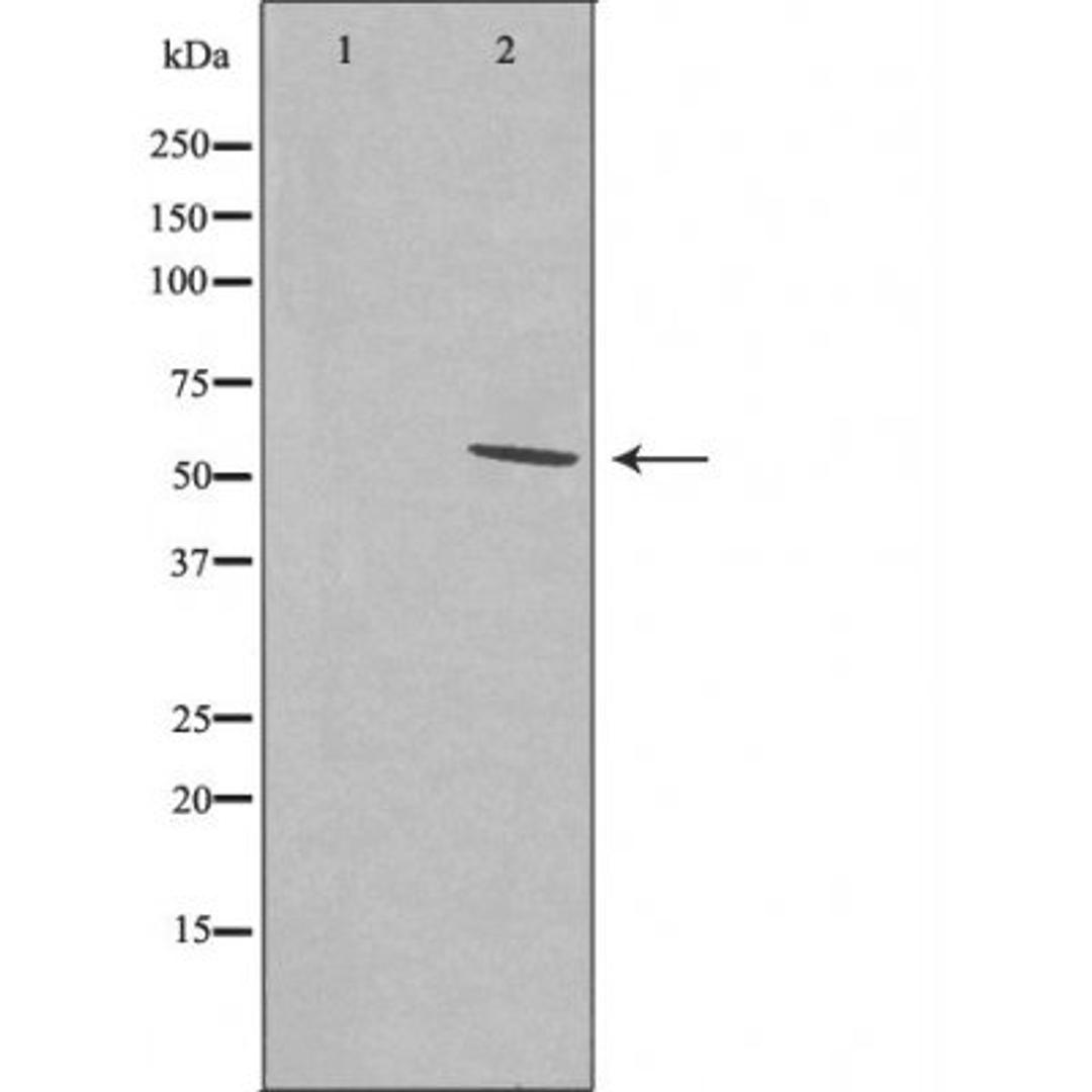 Western blot analysis of LOVO cells and RAW264.7 cells using SFRS11 antibody