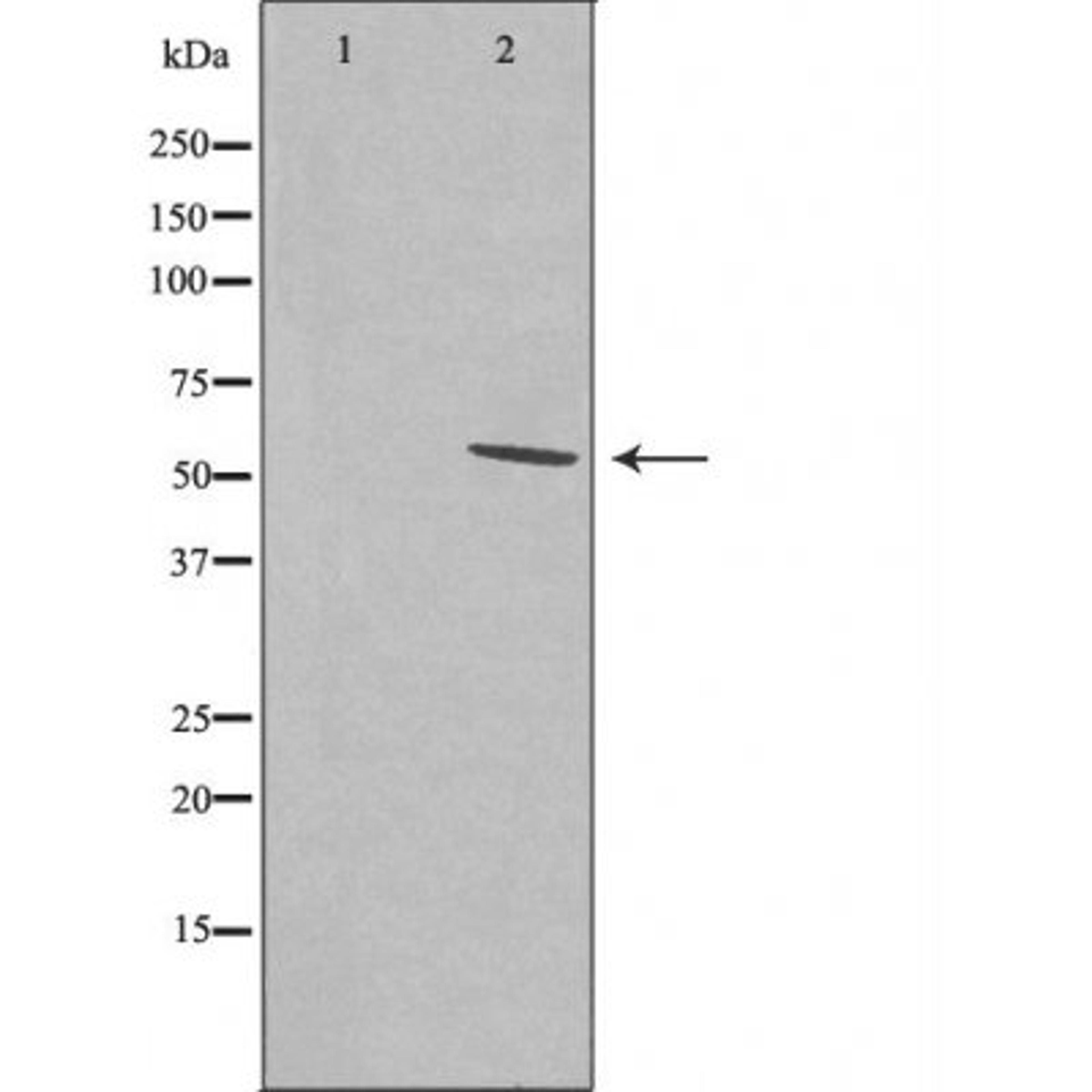 Western blot analysis of LOVO cells and RAW264.7 cells using SFRS11 antibody