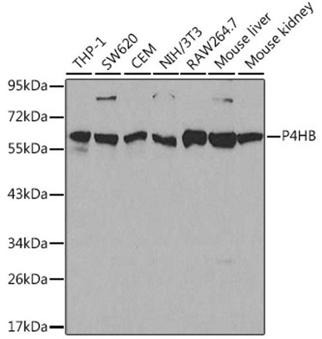 Western blot - P4HB antibody (A0692)