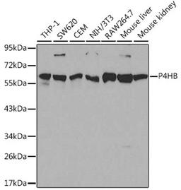 Western blot - P4HB antibody (A0692)