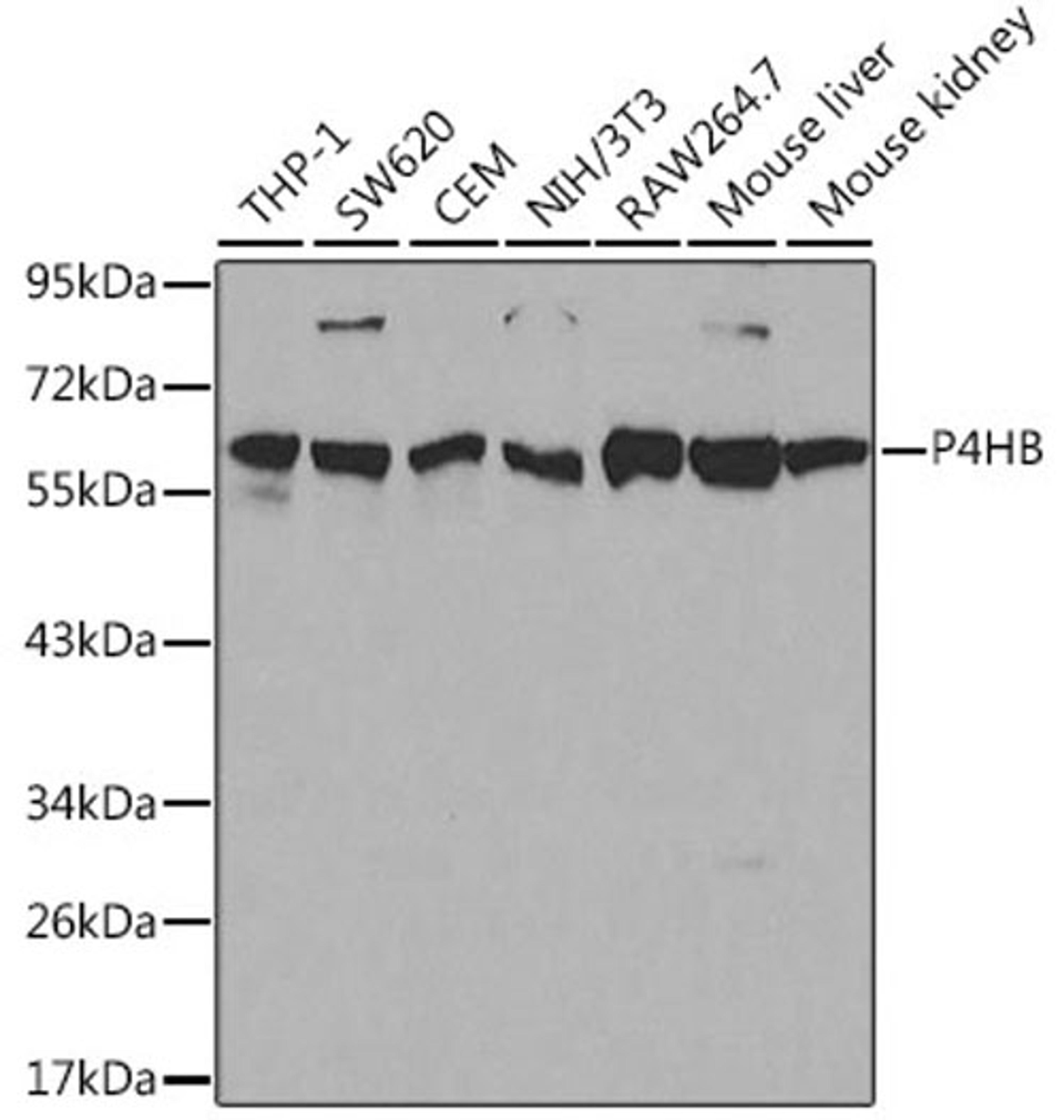 Western blot - P4HB antibody (A0692)