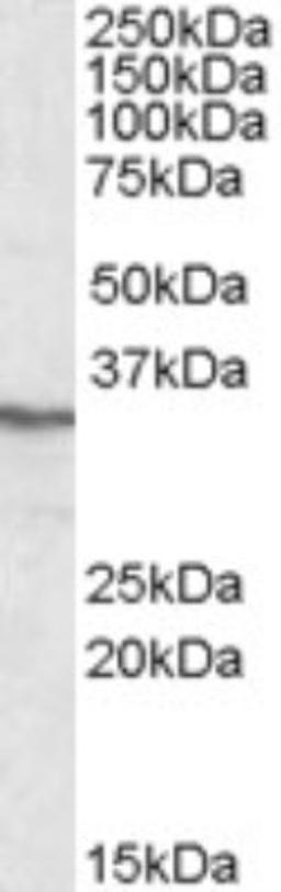 Western Blot: PPP4C Antibody [NBP1-51947] - Western blot analysis of PPP4C in HEK293 lysate (35ug protein in RIPA buffer) using NBP1-51947 at 0.3ug/ml. Primary incubation was 1 hour. Detected by chemiluminescence.