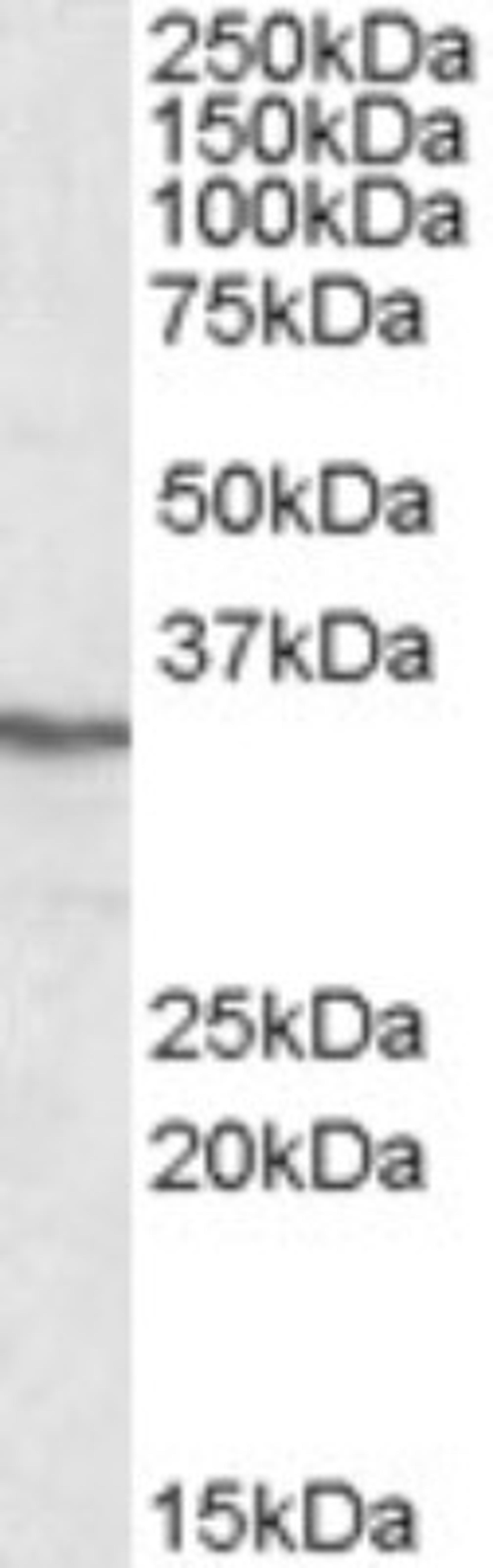 Western Blot: PPP4C Antibody [NBP1-51947] - Western blot analysis of PPP4C in HEK293 lysate (35ug protein in RIPA buffer) using NBP1-51947 at 0.3ug/ml. Primary incubation was 1 hour. Detected by chemiluminescence.