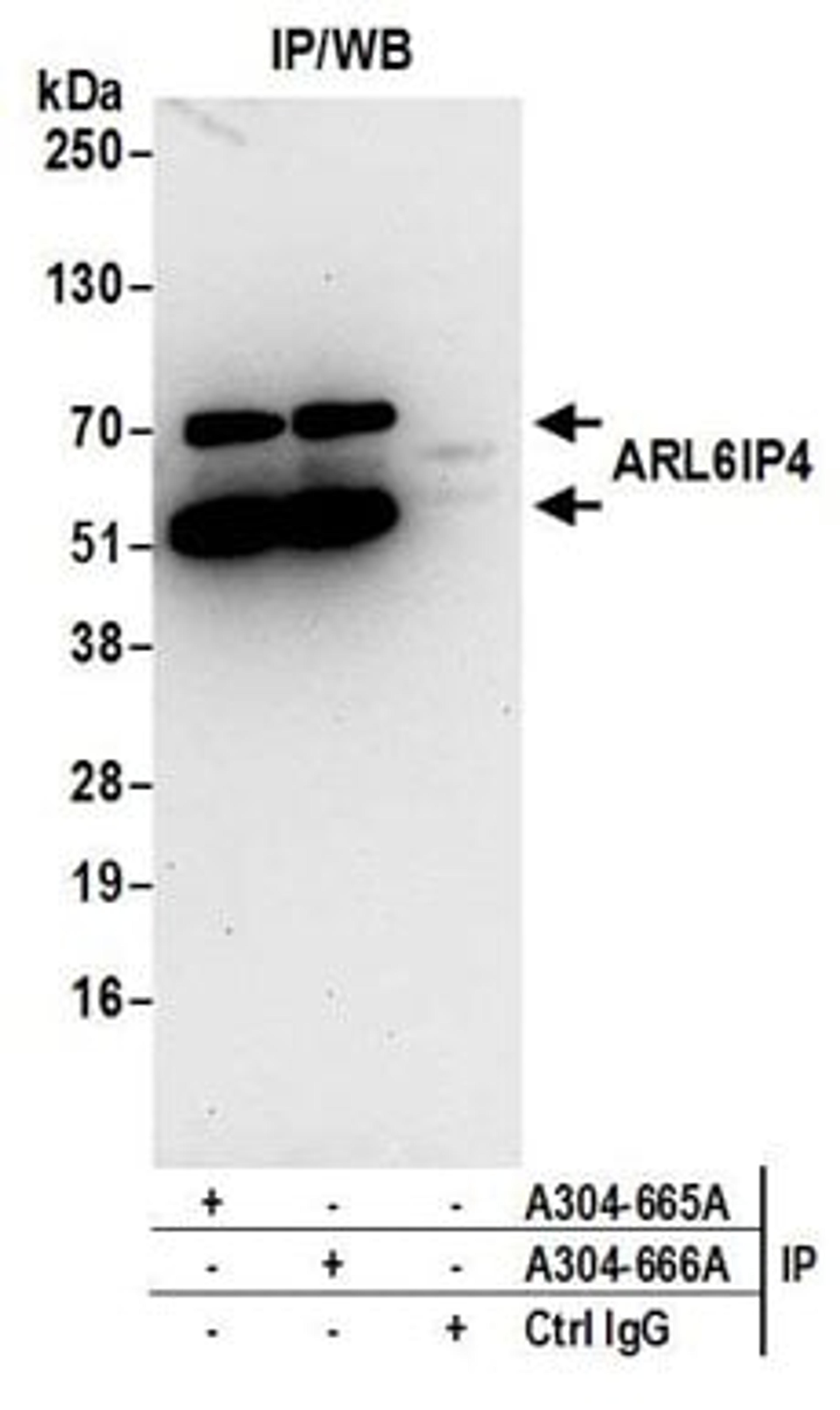 Detection of human ARL6IP4 by western blot of immunoprecipitates.