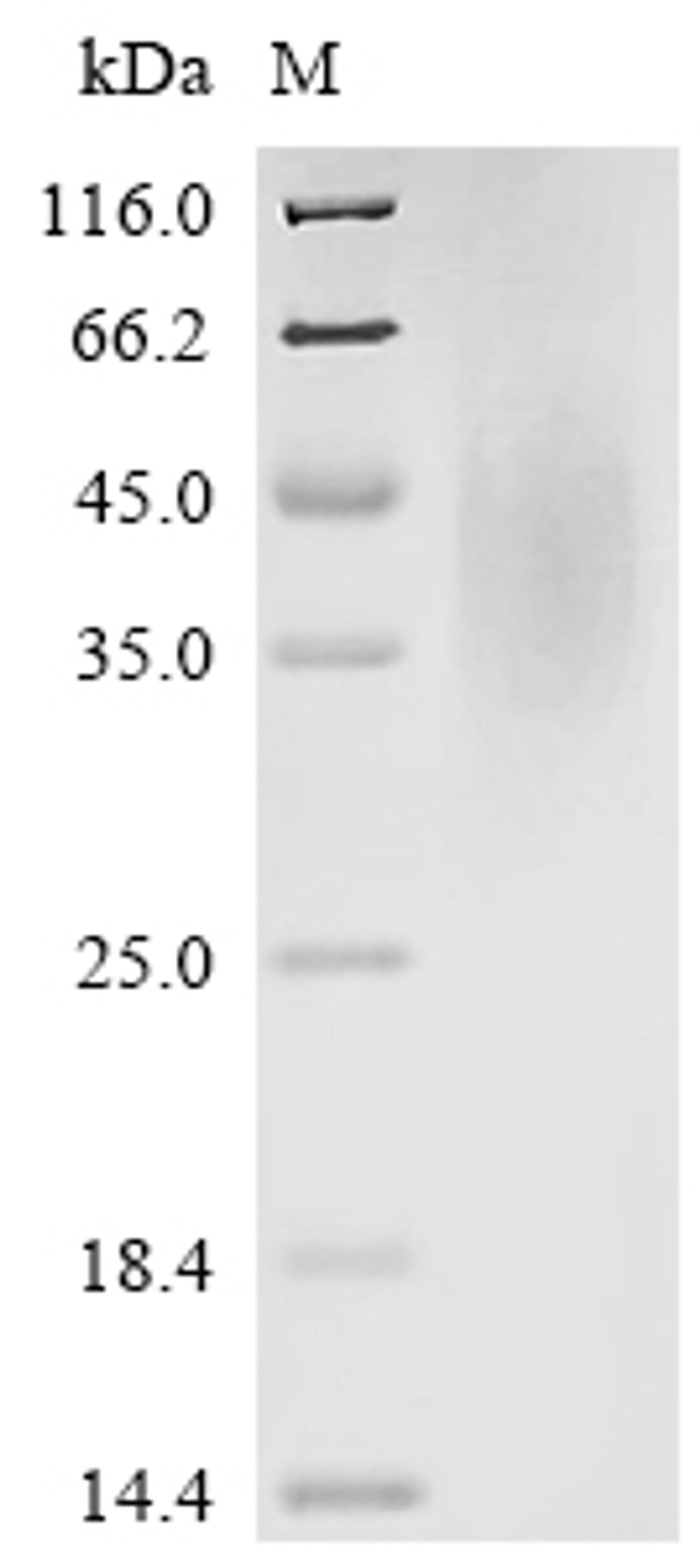 (Tris-Glycine gel) Discontinuous SDS-PAGE (reduced) with 5% enrichment gel and 15% separation gel.
