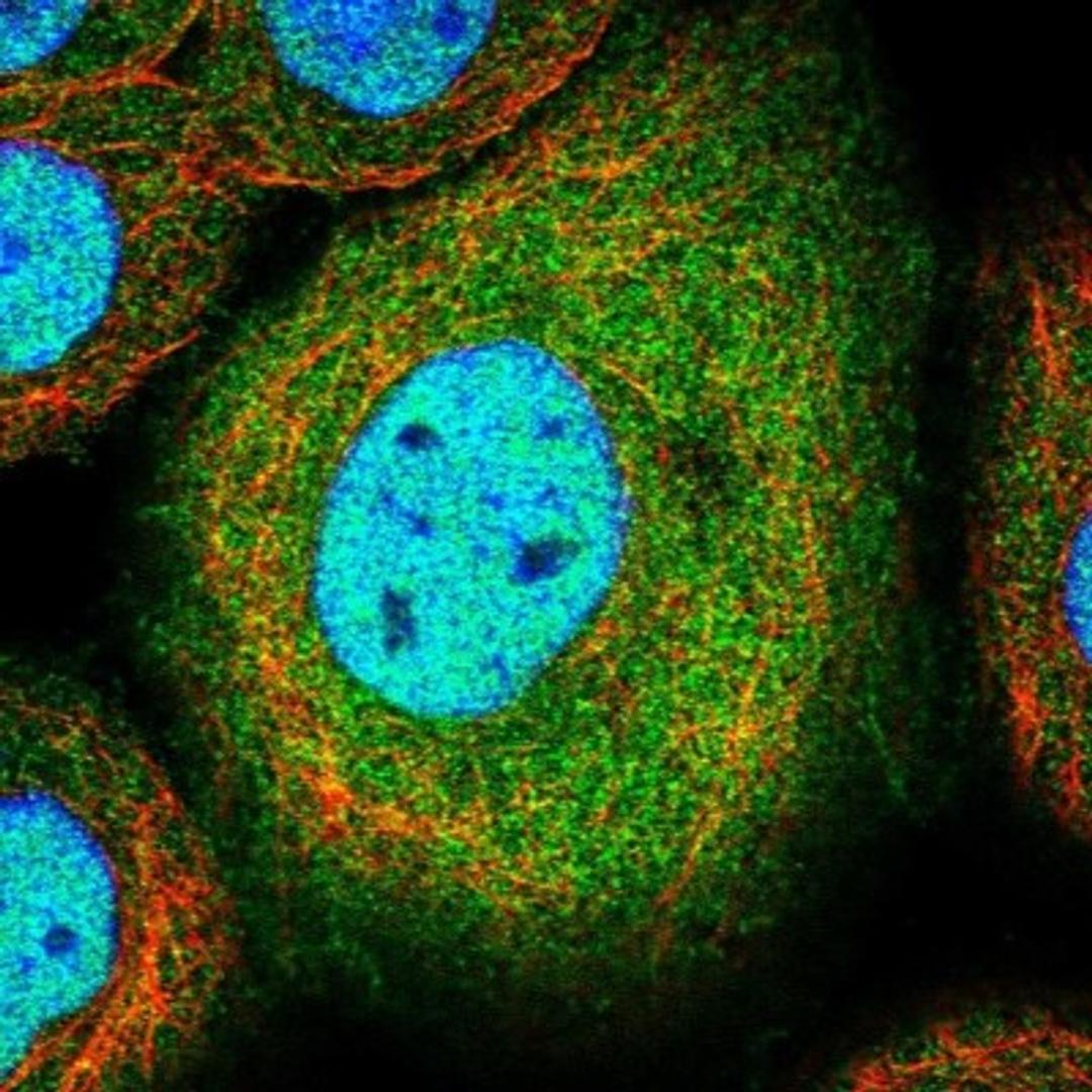 Immunocytochemistry/Immunofluorescence: SSH3 Antibody [NBP1-83804] - Staining of human cell line A-431 shows positivity in nucleus but not nucleoli & cytoplasm.