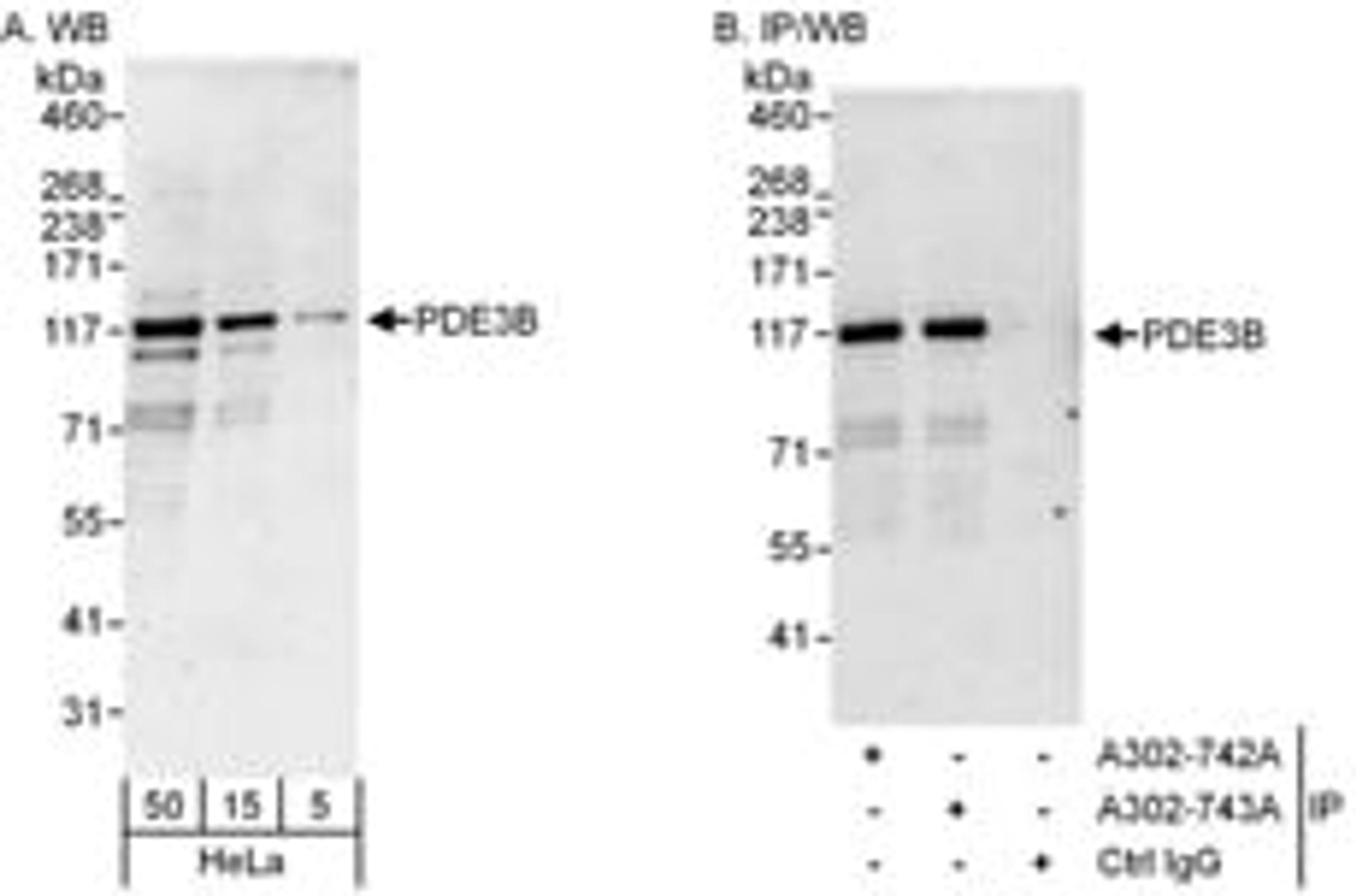 Detection of human PDE3B by western blot and immunoprecipitation.